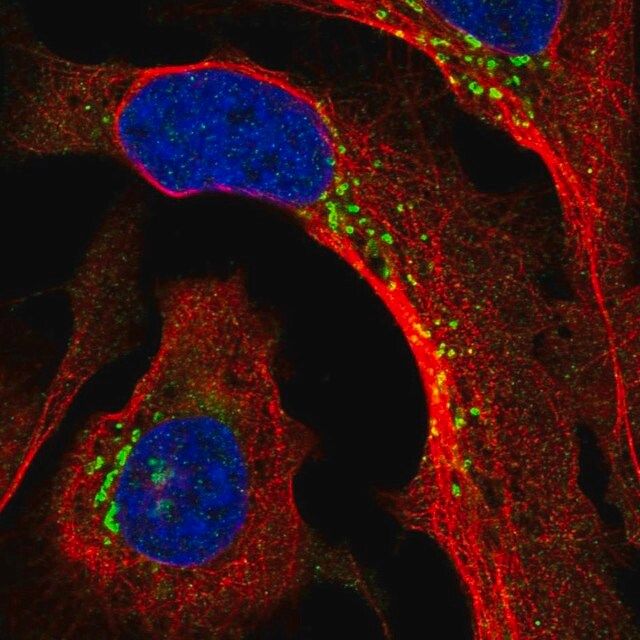 Anti-PPP2R3A antibody produced in rabbit