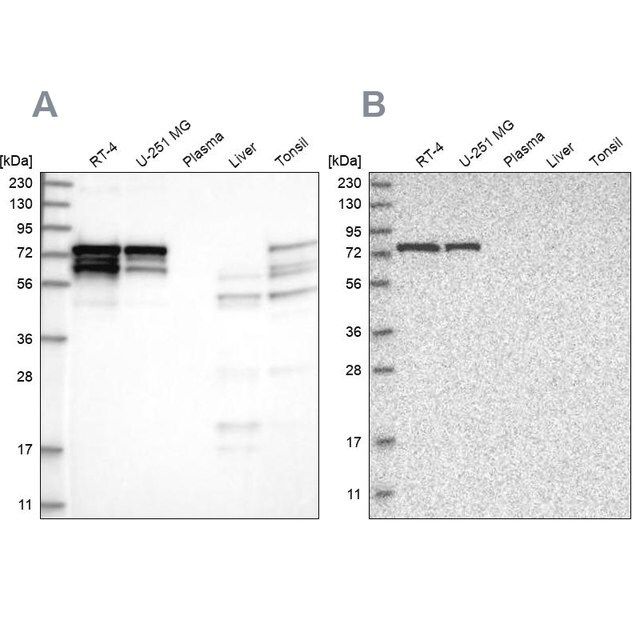 Anti-PPP2R5D antibody produced in rabbit