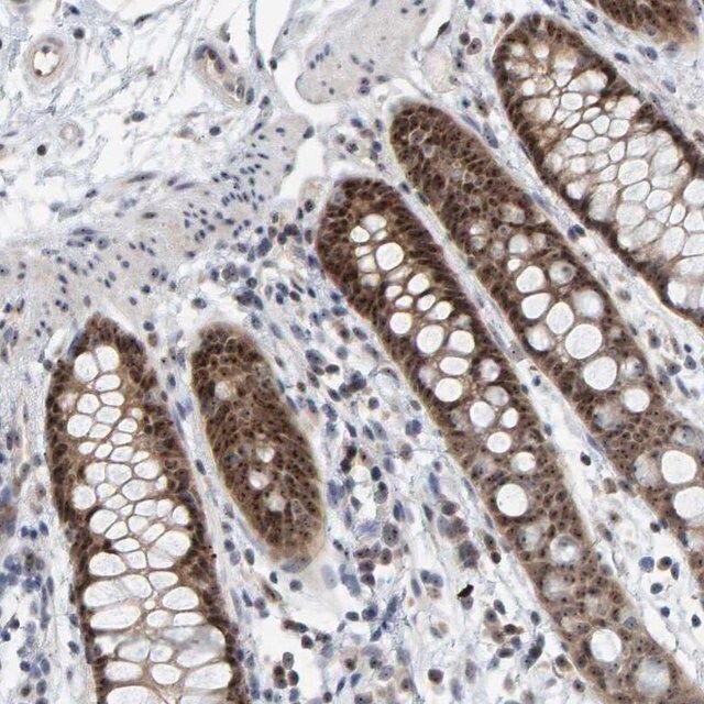 Anti-POLR1E antibody produced in rabbit