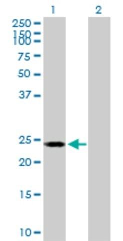 Anti-POLR2E antibody produced in mouse