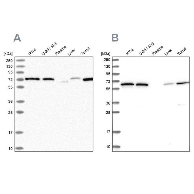 Anti-POLR3E antibody produced in rabbit