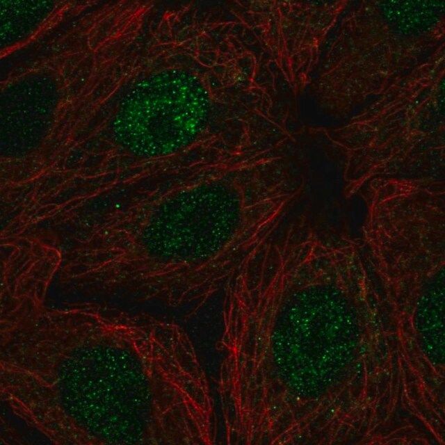 Anti-POLR2I antibody produced in rabbit