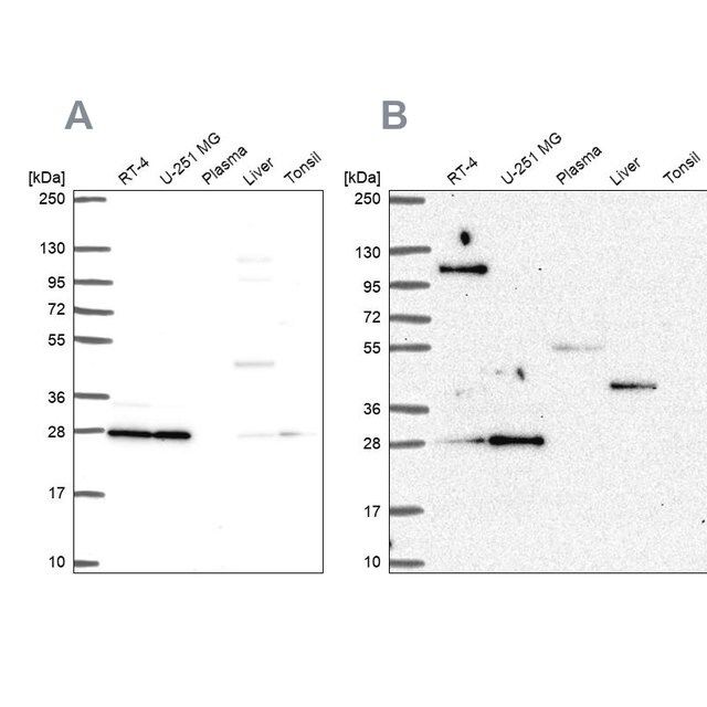 Anti-POLR2E antibody produced in rabbit