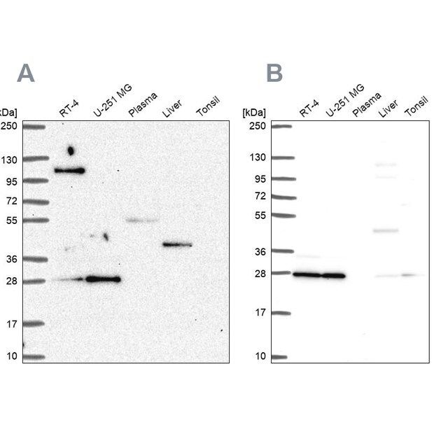 Anti-POLR2E antibody produced in rabbit