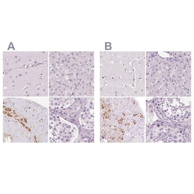 Anti-POMC antibody produced in rabbit