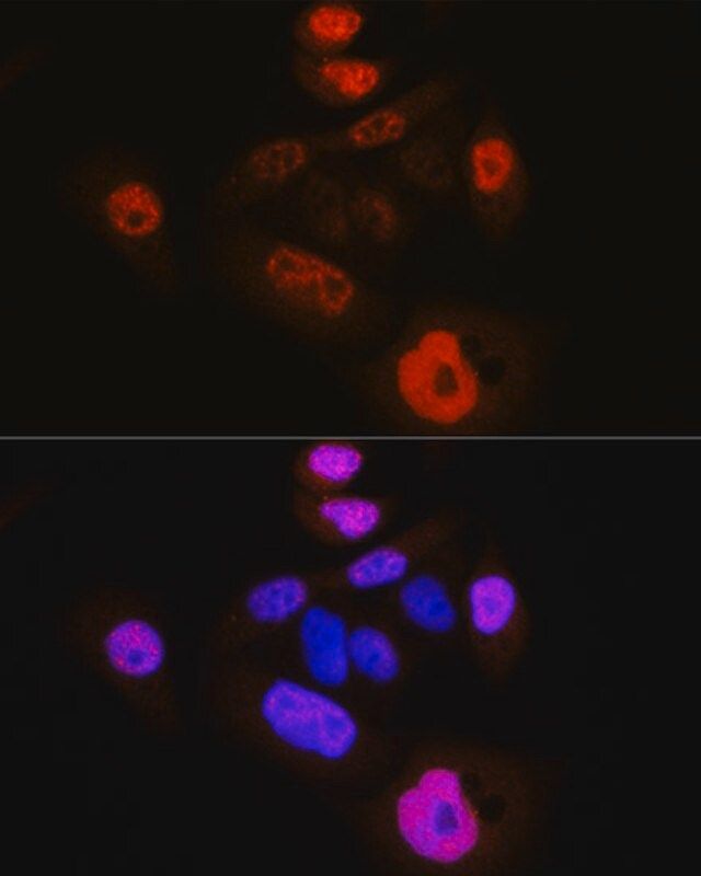 Anti-Phospho-YAP1-S127 antibody produced in rabbit