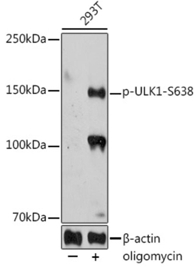 Anti-Phospho-ULK1-S638 antibody produced in rabbit