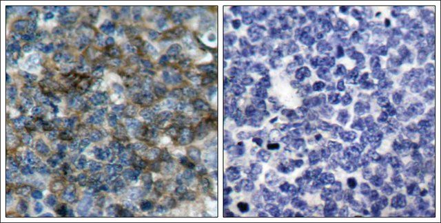 Anti-phospho-VASP (pSer<sup>157</sup>) antibody produced in rabbit