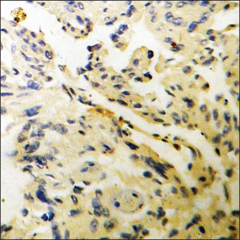 Anti-phospho-WNK1 (pThr<sup>58</sup>) antibody produced in rabbit