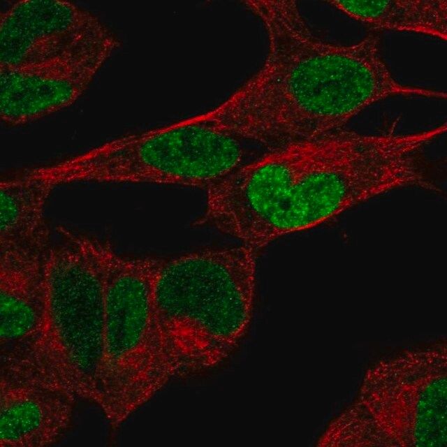 Anti-PHOX2B antibody produced in rabbit