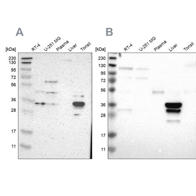 Anti-PHYH antibody produced in rabbit