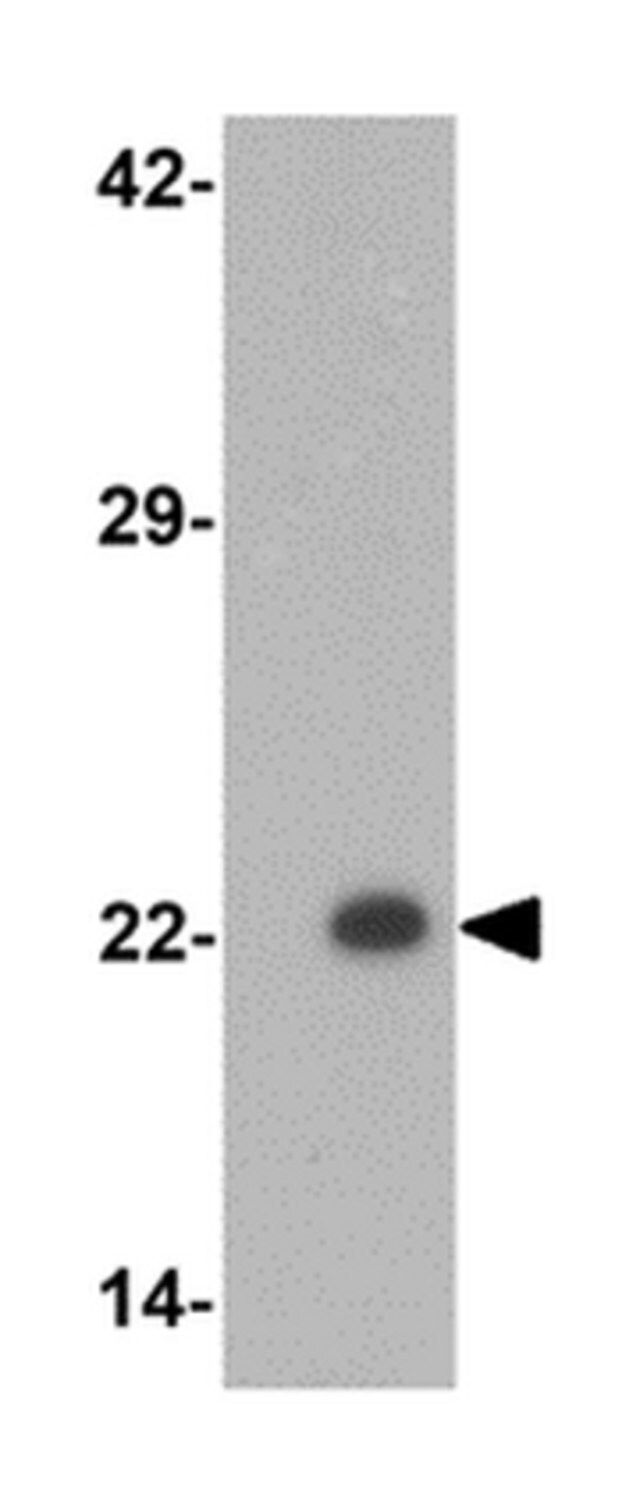 Anti-PHOX2B Antibody