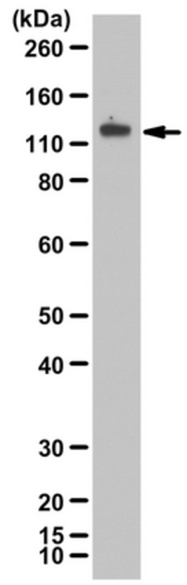 Anti-phospho-VE-Cadherin (Tyr685)