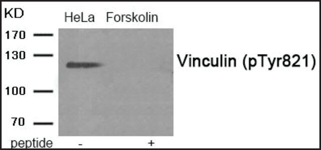 Anti-phospho-Vinculin (pTyr<sup>821</sup>) antibody produced in rabbit