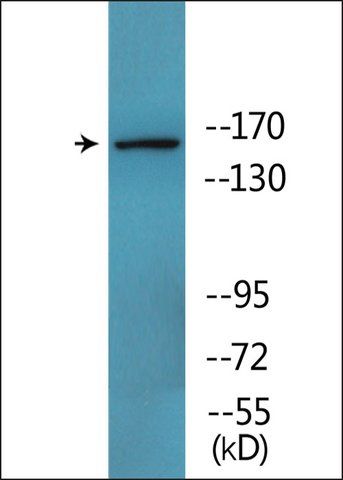 Anti-phospho-Werner Syndrome Helicase (pSer<sup>1141</sup>) antibody produced in rabbit