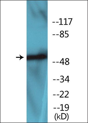 Anti-phospho-WASP (pTyr<sup>290</sup>) antibody produced in rabbit