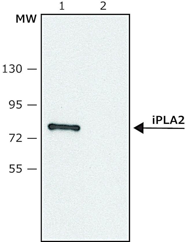 Anti-Phospholipase A2 (iPLA2) (C-terminal region) antibody produced in rabbit