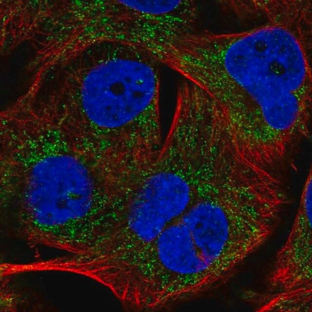 Anti-PHYHIP antibody produced in rabbit