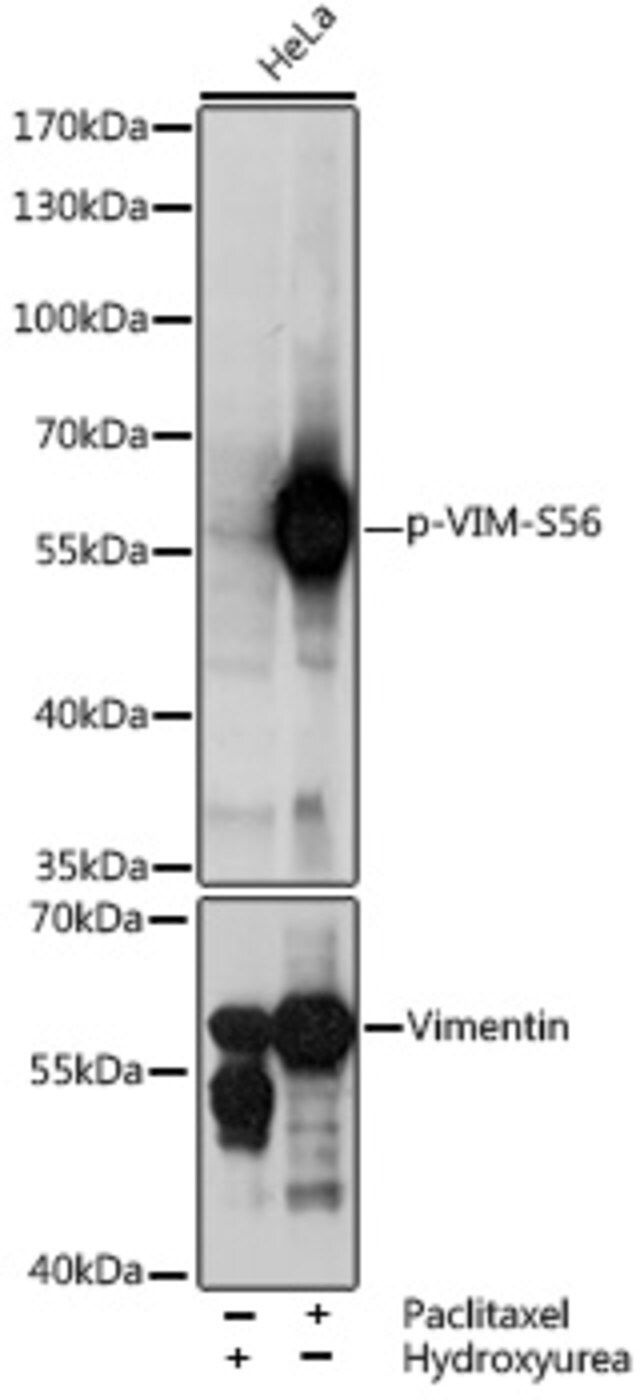 Anti-Phospho-VIM-S56 antibody produced in rabbit