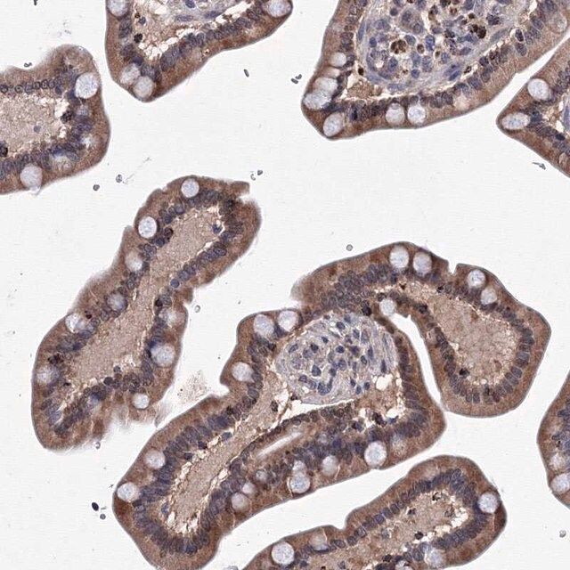 Anti-PHYKPL antibody produced in rabbit