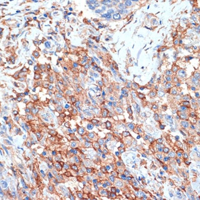 Anti-Phospholipid Scramblase 1 (PLSCR1) antibody produced in rabbit