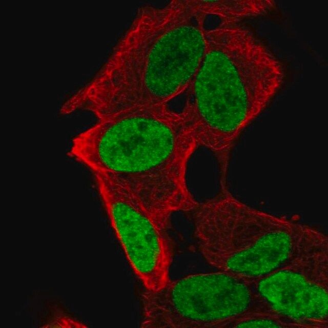 Anti-PHOX2A antibody produced in rabbit