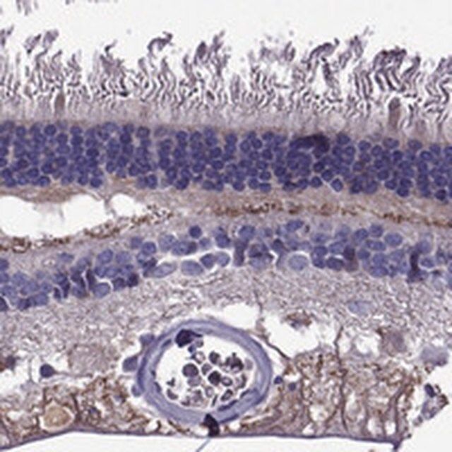 Anti-PI16 antibody produced in rabbit