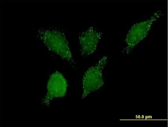 Anti-PHYH2 antibody produced in mouse