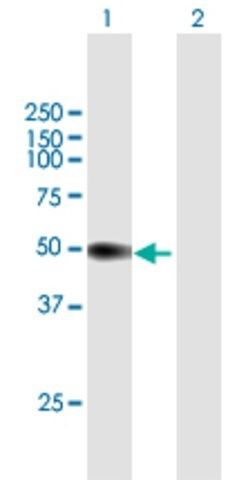 Anti-PI16 antibody produced in mouse