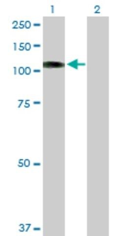 Anti-PKN1 antibody produced in rabbit