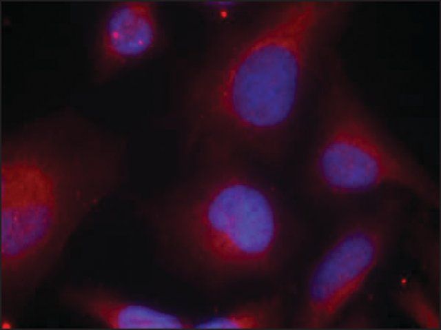 Anti-phospho-MARCKS (pSer<sup>158</sup>) antibody produced in rabbit