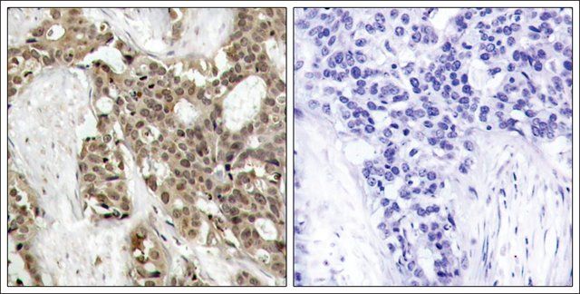 Anti-phospho-MAPK3 (pTyr<sup>204</sup>) antibody produced in rabbit