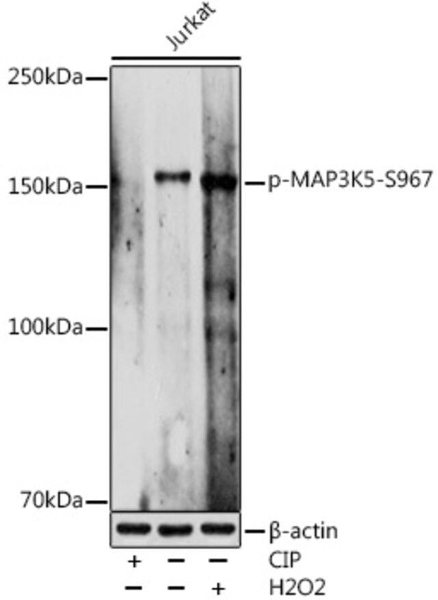 Anti-Phospho-MAP3K5-S967 antibody produced in rabbit