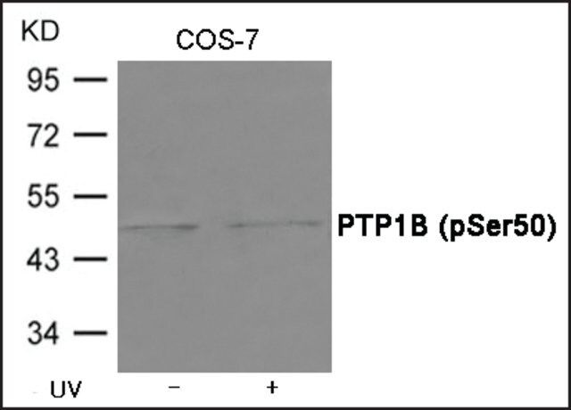 Anti-phospho-PTP1B (pSer<sup>50</sup>) antibody produced in rabbit