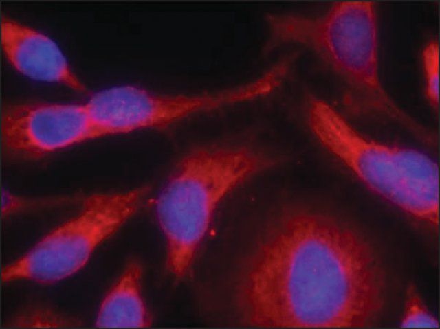 Anti-phospho-PRKD1 (pSer<sup>738</sup>) antibody produced in rabbit