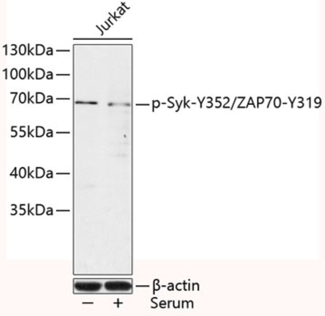 Anti-Phospho-Syk-Y352/ZAP70-Y319 antibody produced in rabbit