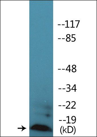 Anti-phospho-Synuclein (pSer<sup>129</sup>) antibody produced in rabbit