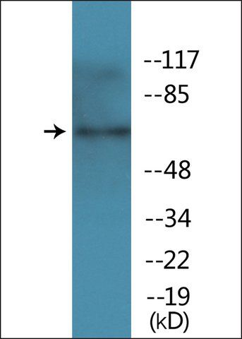 Anti-phospho-TAK1 (pThr<sup>184</sup>) antibody produced in rabbit