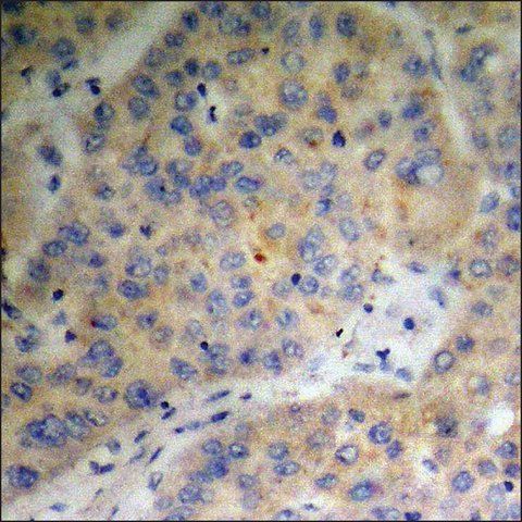 Anti-phospho-Survivin (pThr<sup>34</sup>) antibody produced in rabbit