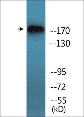 Anti-phospho-TOP2A (pSer<sup>1106</sup>) antibody produced in rabbit