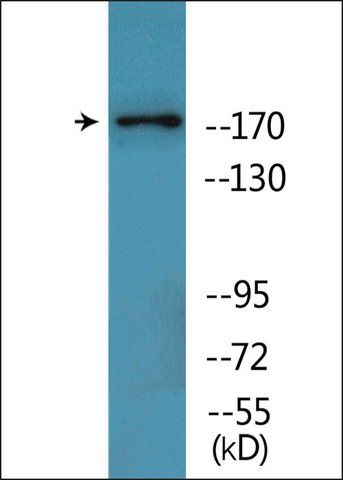 Anti-phospho-TOP2A (pThr<sup>1343</sup>) antibody produced in rabbit