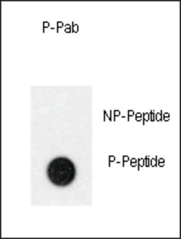 Anti-Phospho-TEK-Y992 antibody produced in rabbit