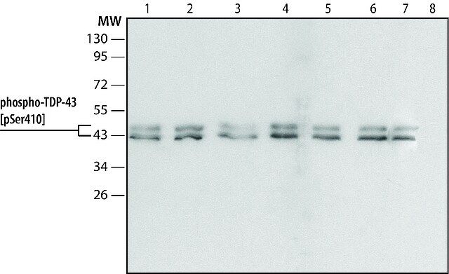 Anti-phospho-TDP-43 (pSer<sup>410</sup>) antibody produced in rabbit