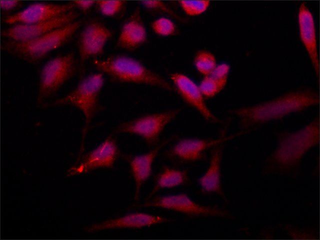 Anti-phospho-TDP-43 [pSer409] antibody produced in rabbit