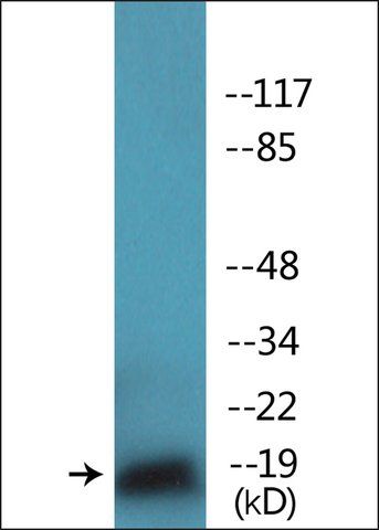 Anti-phospho-TEBP (pSer<sup>113</sup>) antibody produced in rabbit