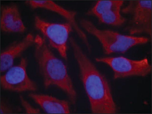 Anti-phospho-SYN1 (pSer<sup>9</sup>) antibody produced in rabbit