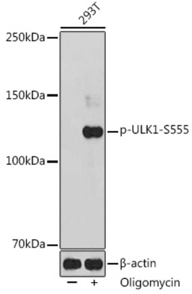 Anti-Phospho-ULK1-S555 antibody produced in rabbit