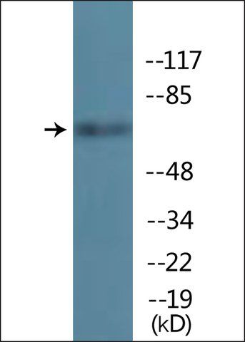 Anti-phospho-TIF-IA (pSer<sup>649</sup>) antibody produced in rabbit