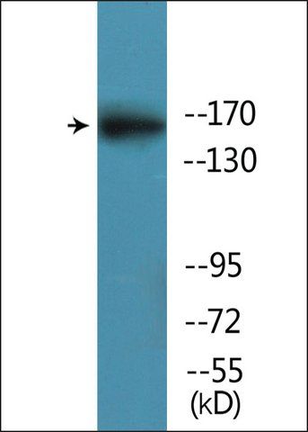 Anti-phospho-GRIN2B (pSer<sup>1303</sup>) antibody produced in rabbit