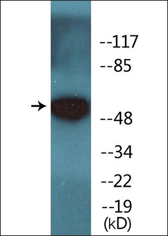 Anti-phospho-HBP1 (pSer<sup>402</sup>) antibody produced in rabbit